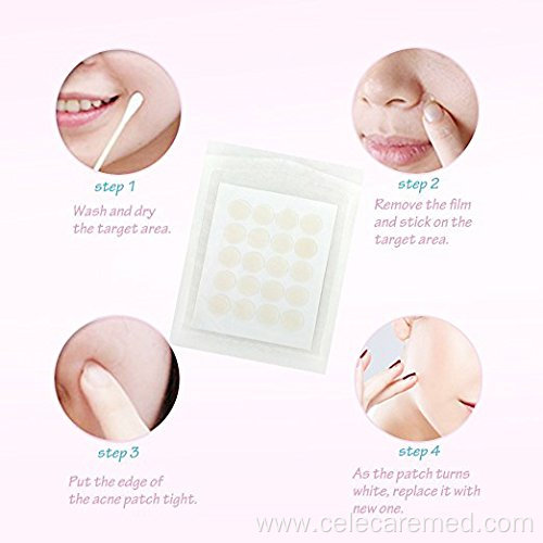 Acne Patch Custom Disposable Hydrocolloid Acne Pimple Patch